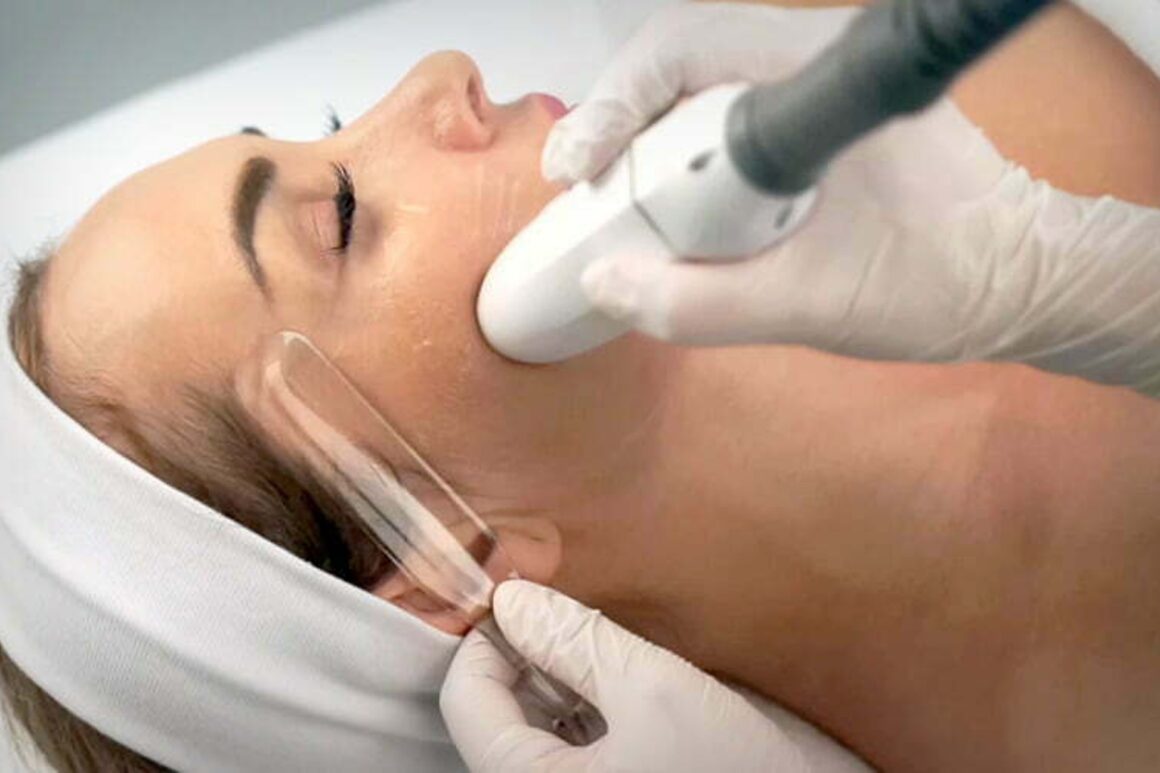 Lifting sem cirurgia? O tratamento chegou a Portugal